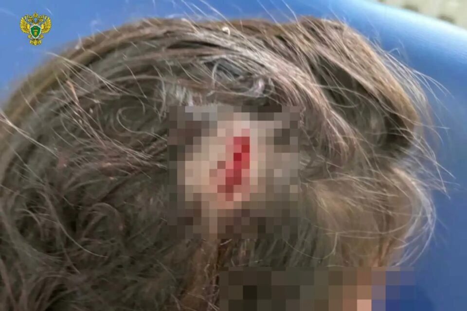 С детского сада в Якутии взыскали компенсацию за травму ребенка 